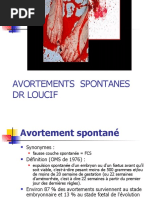 Gyneco5an-Avortements Spontanes2019loucif