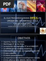 EKG DIFICIL EN SCA Nuevo PDF