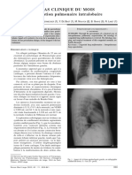 Séquestration Pulmonaire MAR