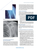 Luxaciones PDF