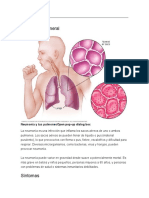 Neumonía