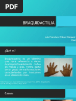 BRAQUIDACTILIA