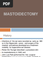 Mastoidectomy Indications, Types, Procedure