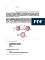 Resumen Glaucoma