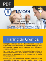 Faringitis Cronica