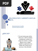 Reanimacion Cardiopulmonar (RCP)