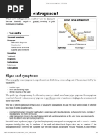 Ulnar Nerve Entrapment - Wikipedia