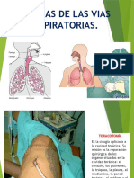 Cirugias de Las Vias Respiratorias