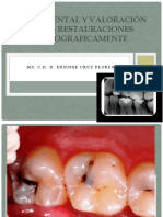 Caries Dental y Valoración