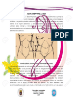 ABDOMINOPLASTIA