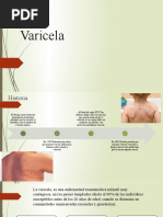 Varicela