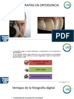 Clase 2 Fotografias en Ortodoncia