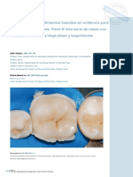 EVIDENCE BASED CONCEPTS AND PROCEDURE FOR BONDED INLAYS AND ONLAYS PART 3.en - Es