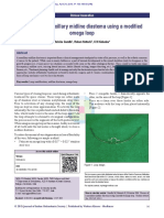 Closure of A Maxillary Midline Diastema Using A Modified Omega Loop