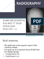 Skull Radiography: Nams Bir Hospital B.SC - MIT 1 Year Suraj Sah Roll No:-9