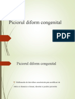 Piciorul Diform Congenital