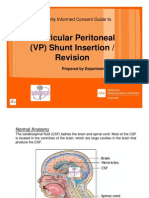 Ventricular Peritoneal Shunt