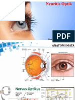 Neuritis Optic