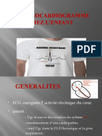 Electrocardiogramme Chez L'Enfant