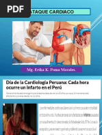 Ataque Cardiaco