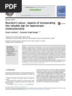 2018 - Rouviere's Sulcus-Aspects of Incorporating This Valuable Sign For Laparoscopic Cholecystectomy