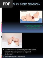 03 - Manejo y Tratamiento de Onfalocele y Gastrosquisis