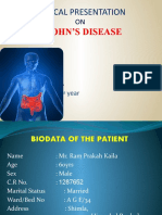 Crohn's Disease