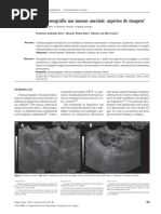 Ultrassonografia Das Massas Anexiais PDF