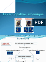 L'angine de La Poitrine