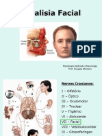 10 - Paralisia Facial