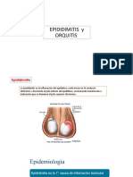 Orquitis Epididimitis