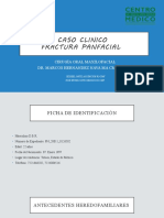 Caso FX Panfacial