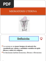 3 Miomatosis-Uterina