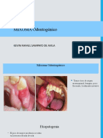 MIXOMA ODONTOGéNICO 2