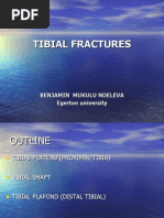 16th TIBIAL Fractures