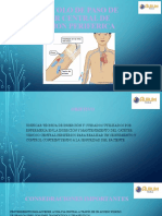Protocolo de Paso de Cateter Central de Insercion