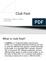 Club Foot POC Report