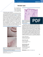 Lupus Neonatal