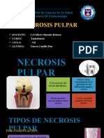 Necrosis Pulpar