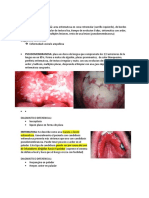 Descripcion de Lesiones Orales