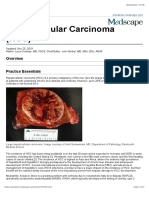 Hepatocellular Carcinoma (HCC)