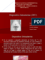 Dispositivo Intrauterino (DIU)