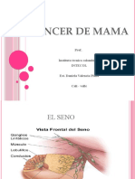 Presentación Cancer de Mama