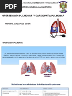 Hipertension Pulmonar