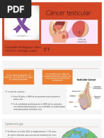 Cancer Testicular