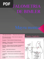 Cefalometria de Bimler