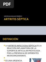 Artritis Séptica