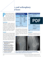 Osteoarthritis and Arthroplasty of The Hip and Knee 2018 PDF