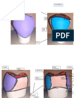 Macrodiente de Premolar