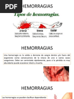 Hemorragias